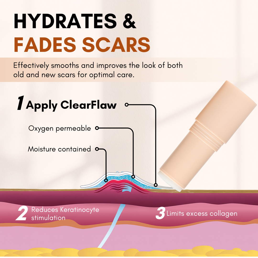 Scar Solutions Silicone Scar Stick